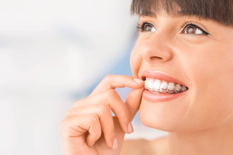 Invisalign, orthodontie invisible Invisalign - orthodontie invisible